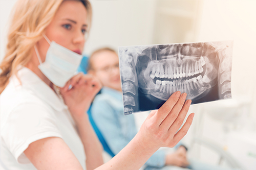 Beverly Hills Complete Dentistry | Snoring Appliances, Oral Cancer Screening and Dental Sealants