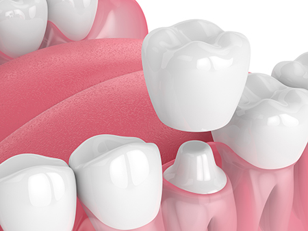 Beverly Hills Complete Dentistry