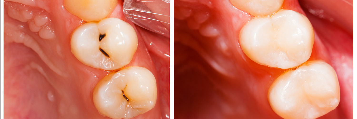Beverly Hills Complete Dentistry