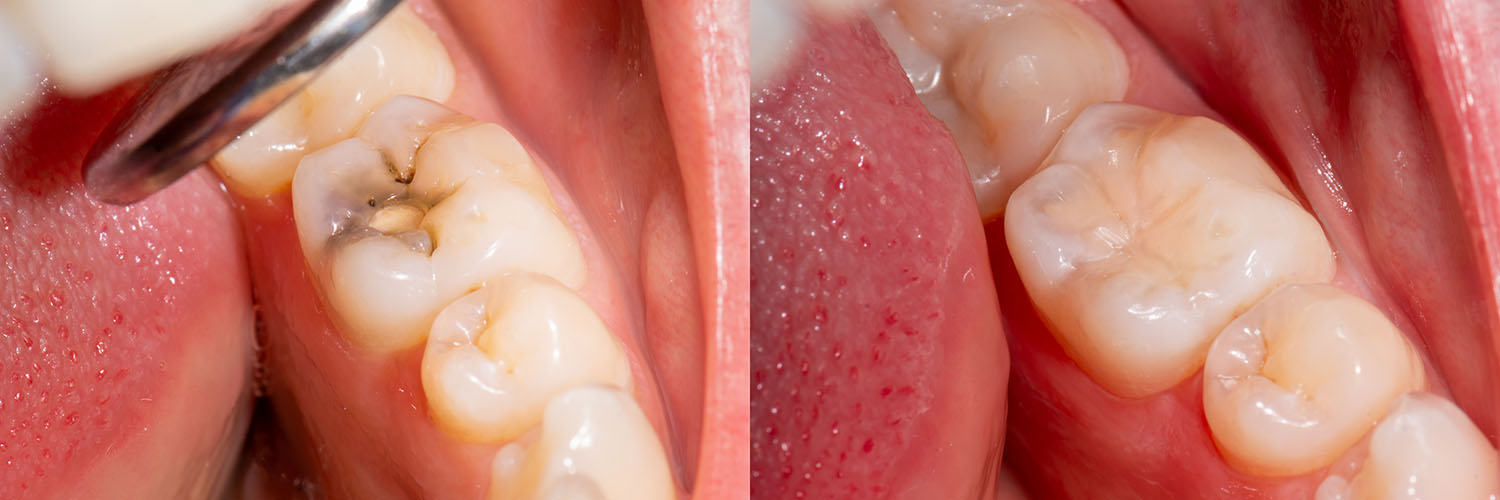 Beverly Hills Complete Dentistry