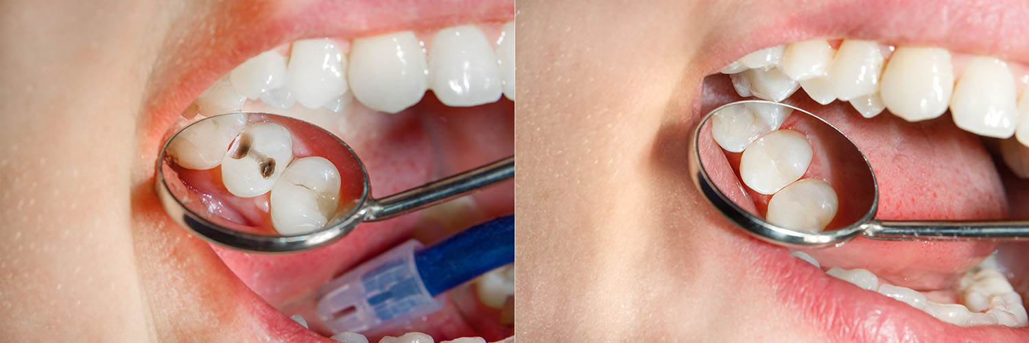 Beverly Hills Complete Dentistry