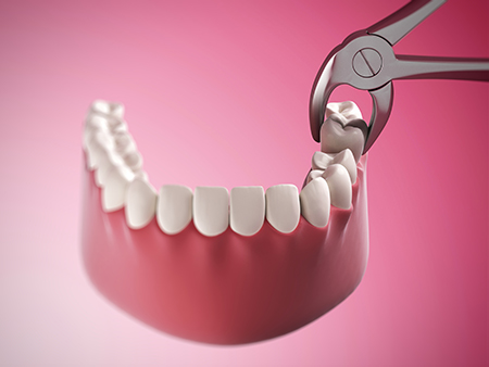 Beverly Hills Complete Dentistry