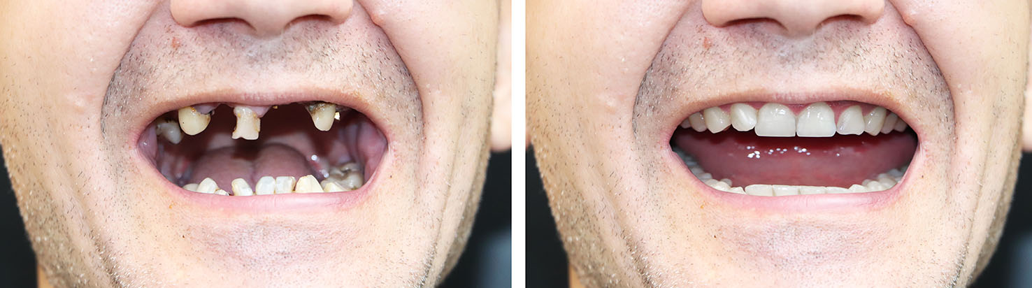 Beverly Hills Complete Dentistry