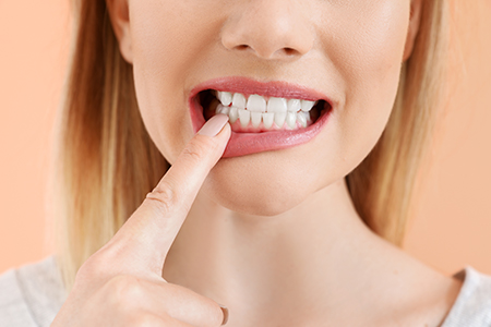 Beverly Hills Complete Dentistry
